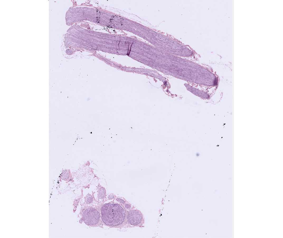 #81 Sciatic Nerve, Rabbit or Monkey, 2 sections (H&E)
