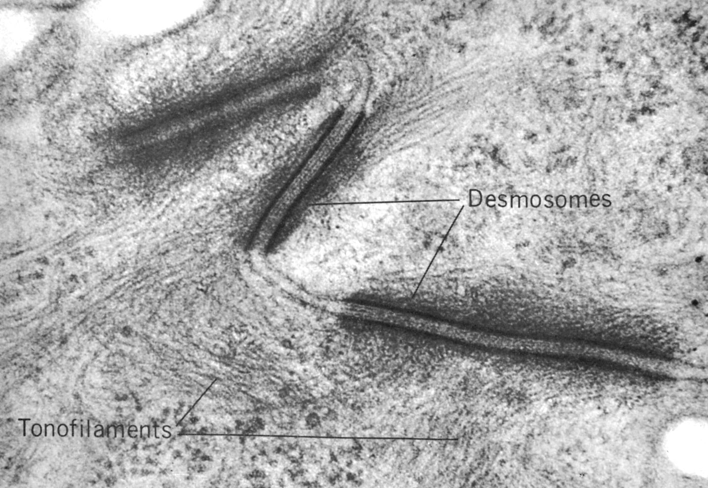 Desmosomes in stratum spinosum