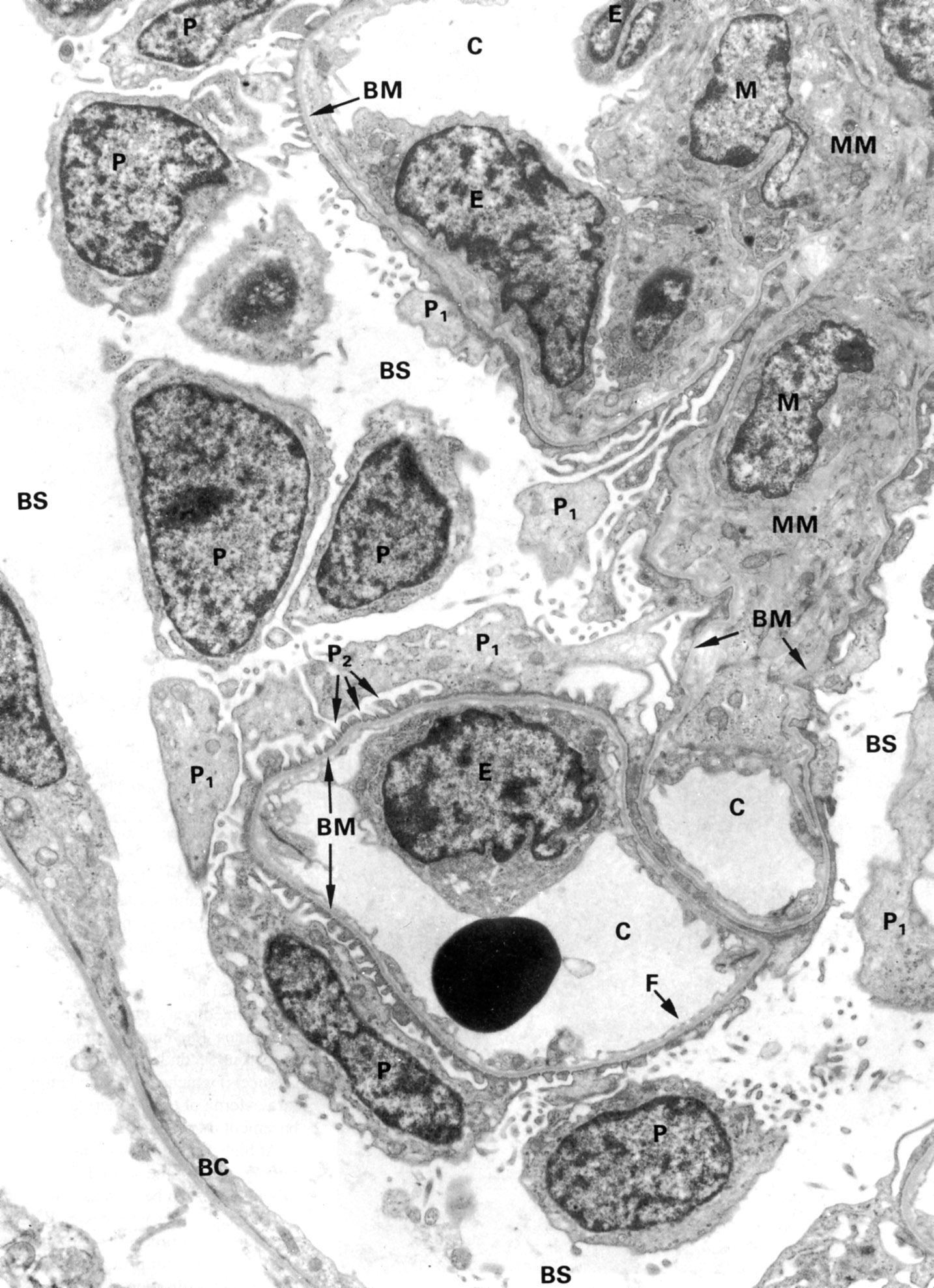 Bowman�s capsule and glomerulus