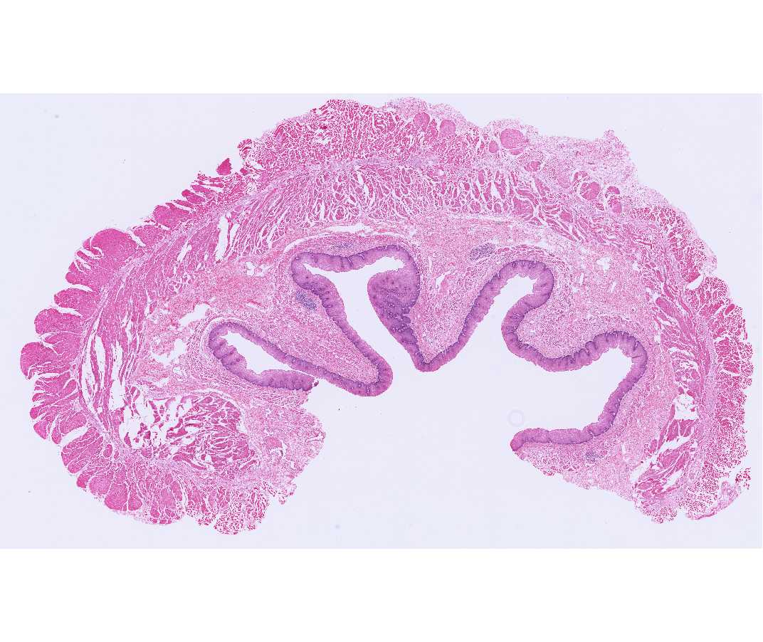 #32 Esophagus (and trachea), Human, Upper One-Third 