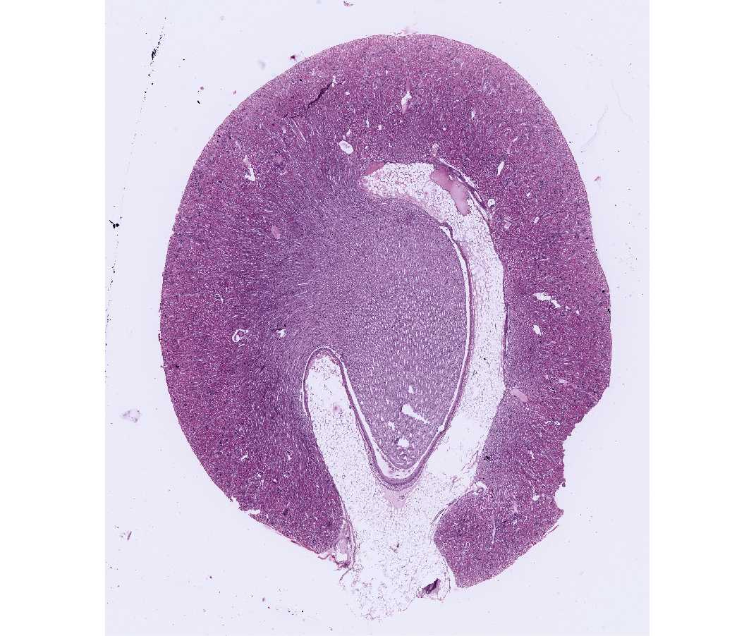 #50 Kidney