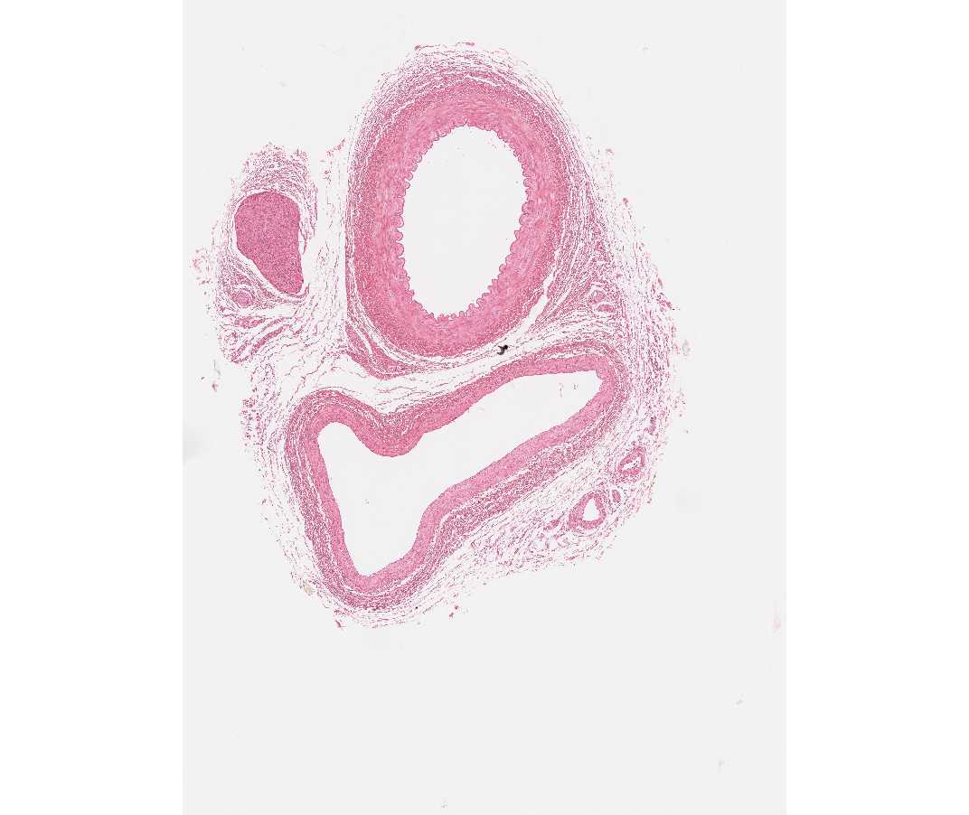 #113 Artery, vein, nerve, primate
