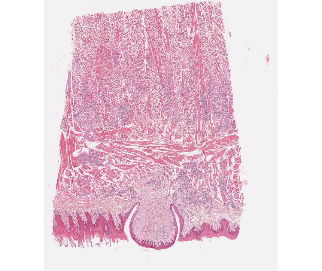 #116 Tongue, human, circumvallate papillae, H & E