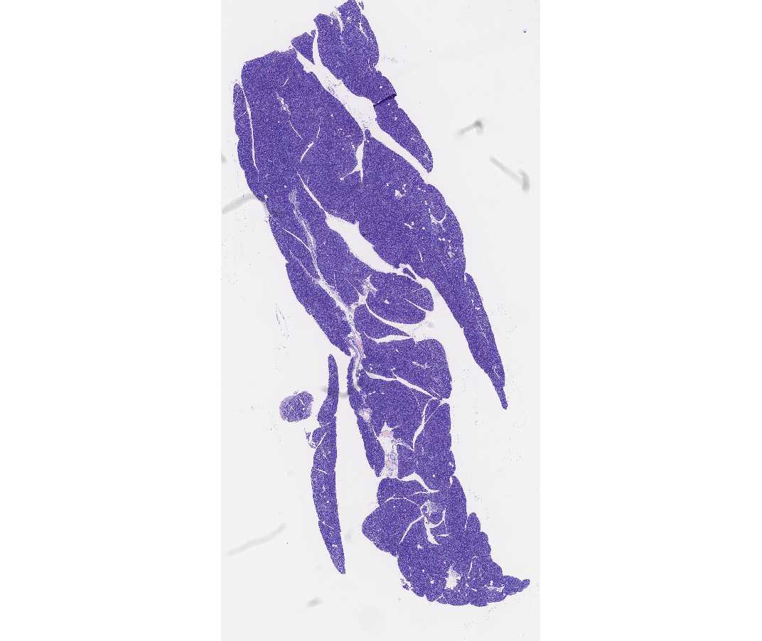 #107 Pancreas, Acid fuchsin and toluidine blue
